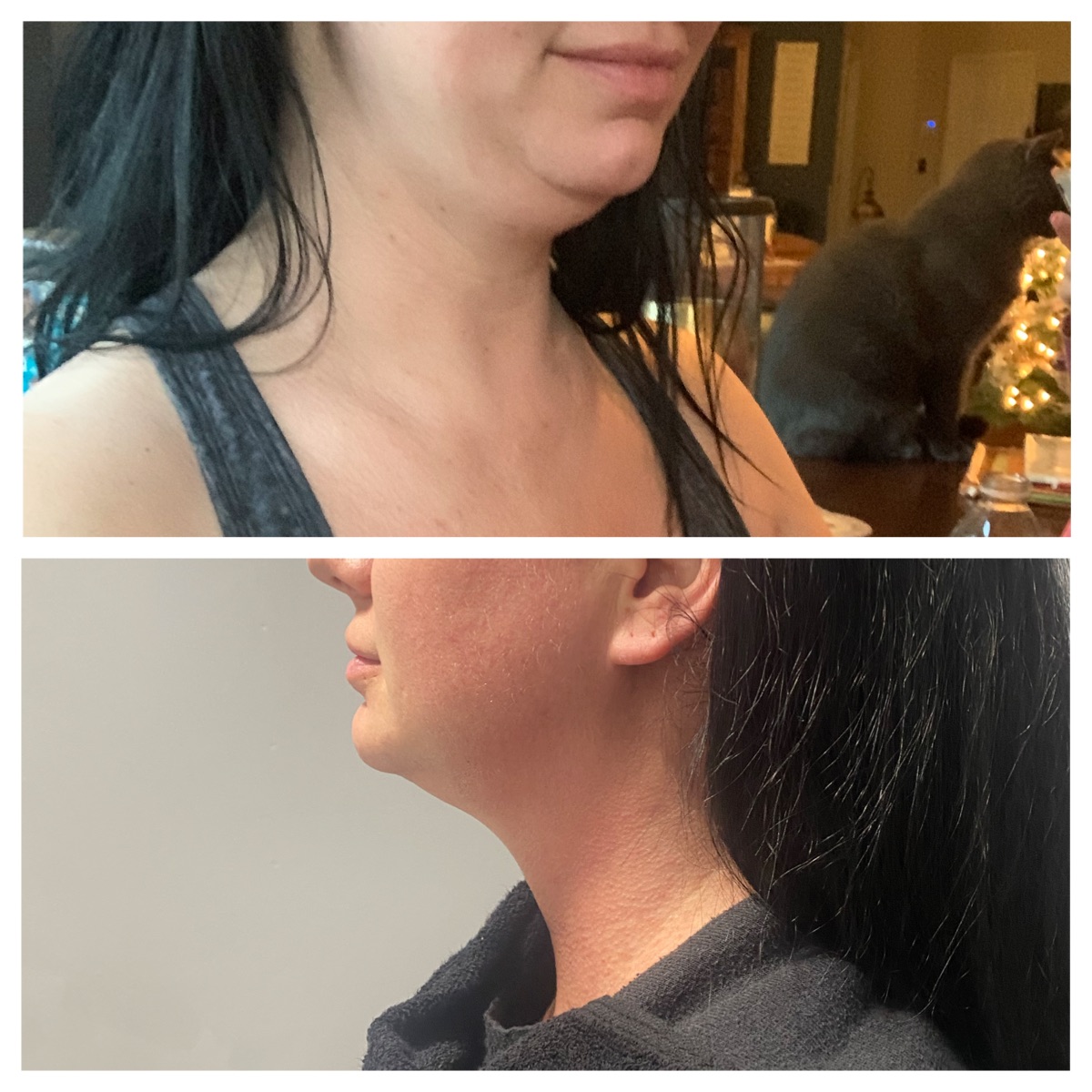 CryoSlimming, CryoToning, and CryoFacial Results NorCal CryoSlim