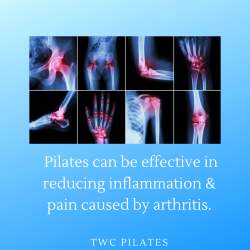 arthritis