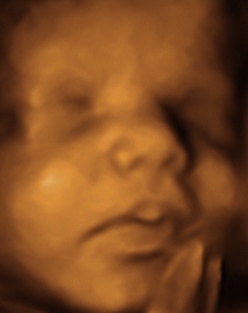 BABY BRADY_78