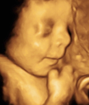 BABY CADE_28