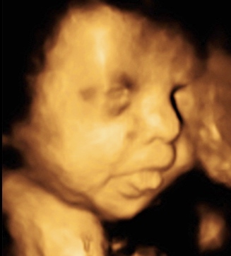 BABY CADE_88