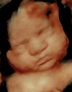 BABY PAIZLEE_38