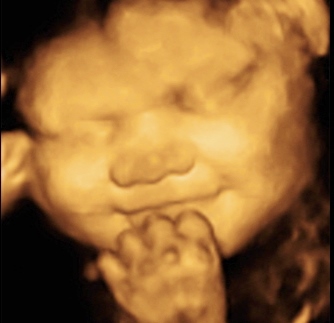 LYONS BABY GIRL_58