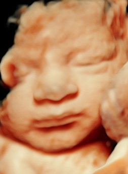 ROSS BABY_126_copy