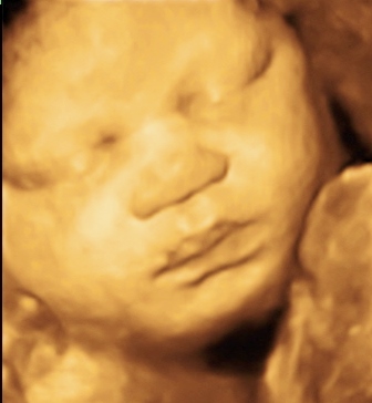SMITH BABY GIRL_38
