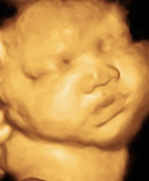 LYONS BABY GIRL_48