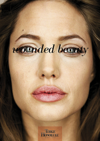 wounded-beauty-angelina-jolie