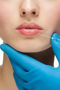 lip injection 1