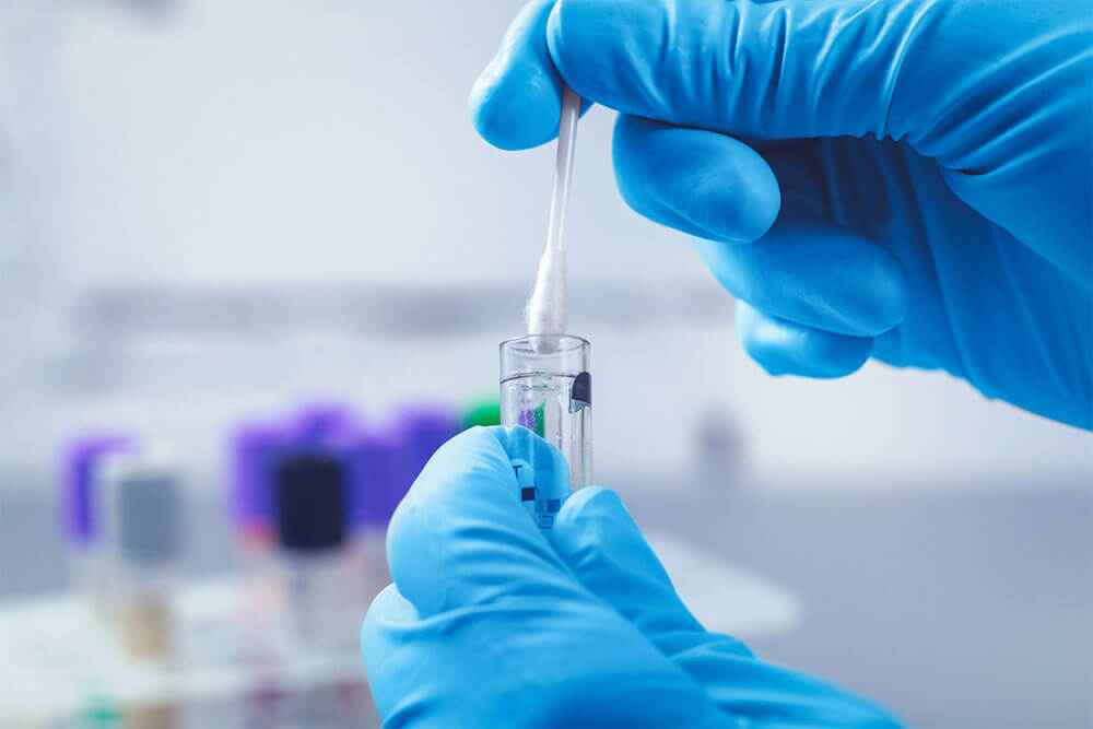 DNA-test-swab
