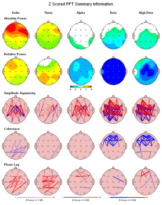 qeeg-brain-mapping-neurofield-neurotherapy-inc-ca-93101