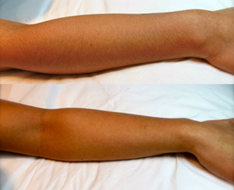 waxing