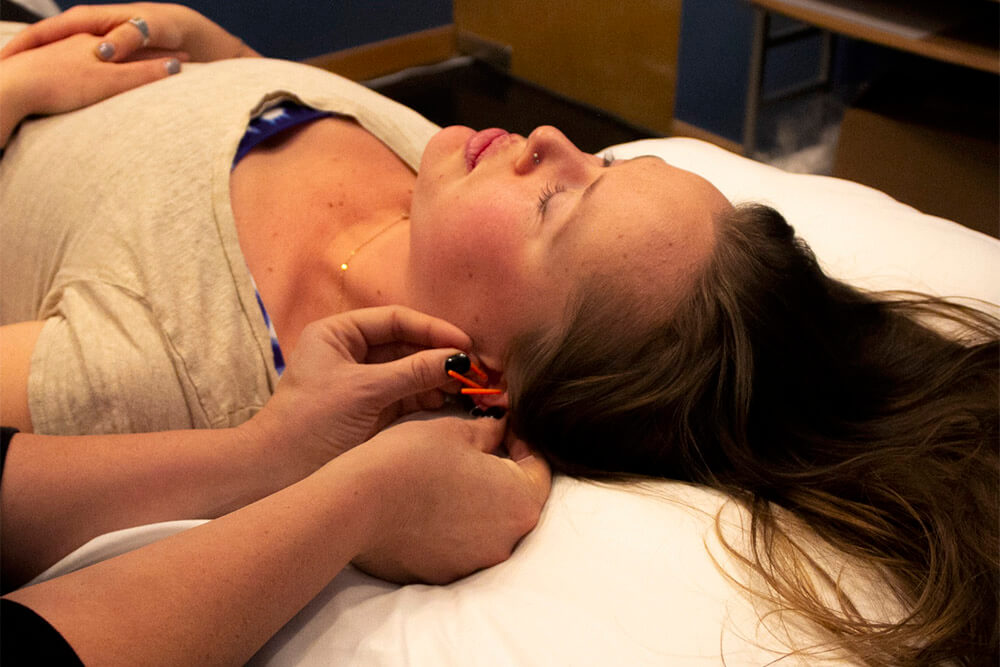ear-acupuncture