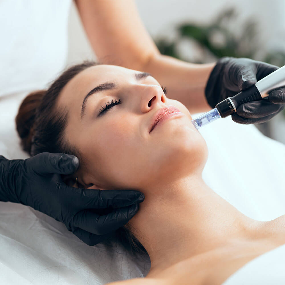 Microneedling-MOBO-Med-Spa