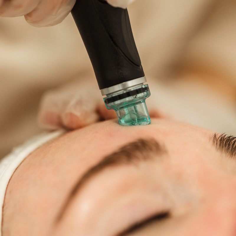 Hydradermabrasion-Suction-Facial