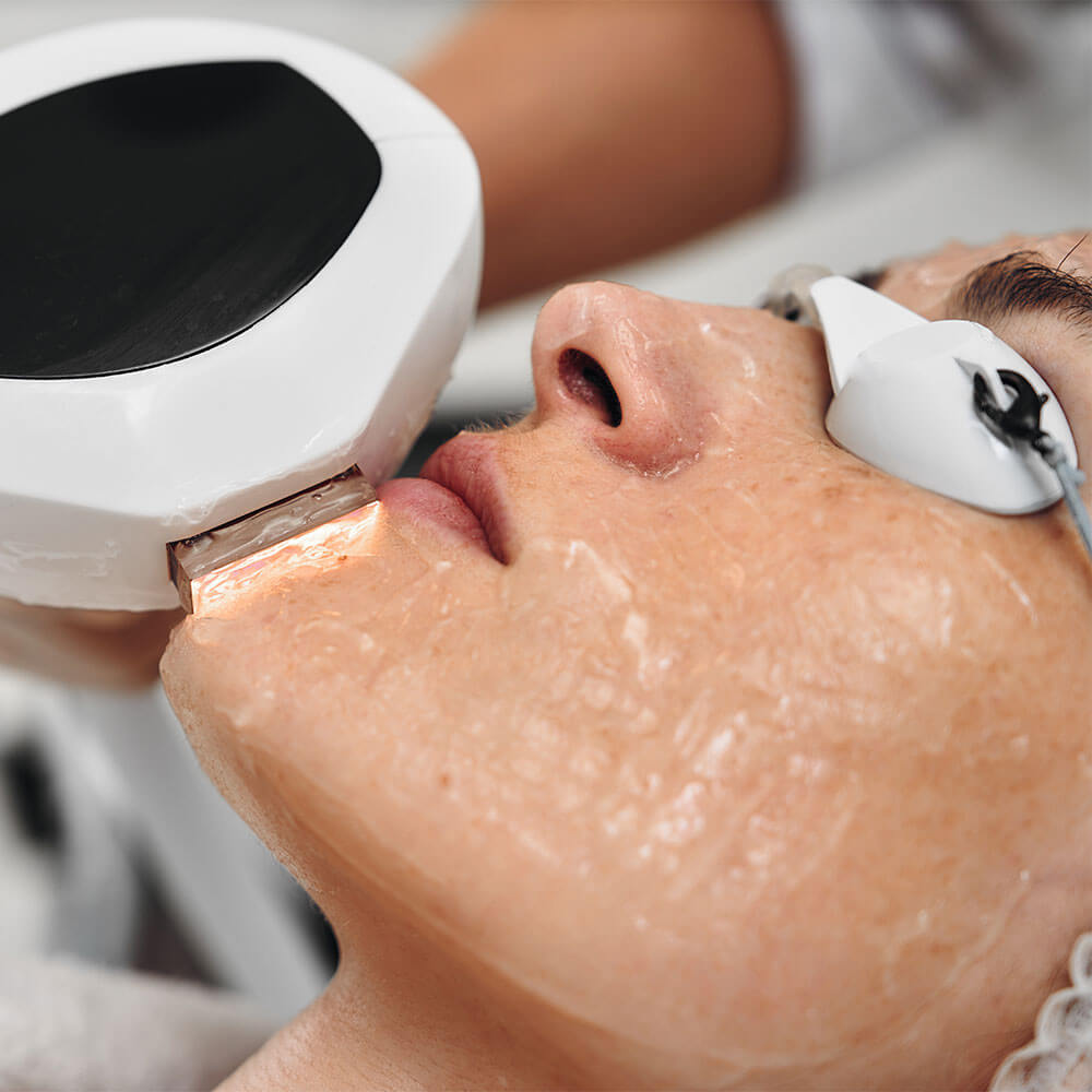 IPL-MOBO-Med-Spa