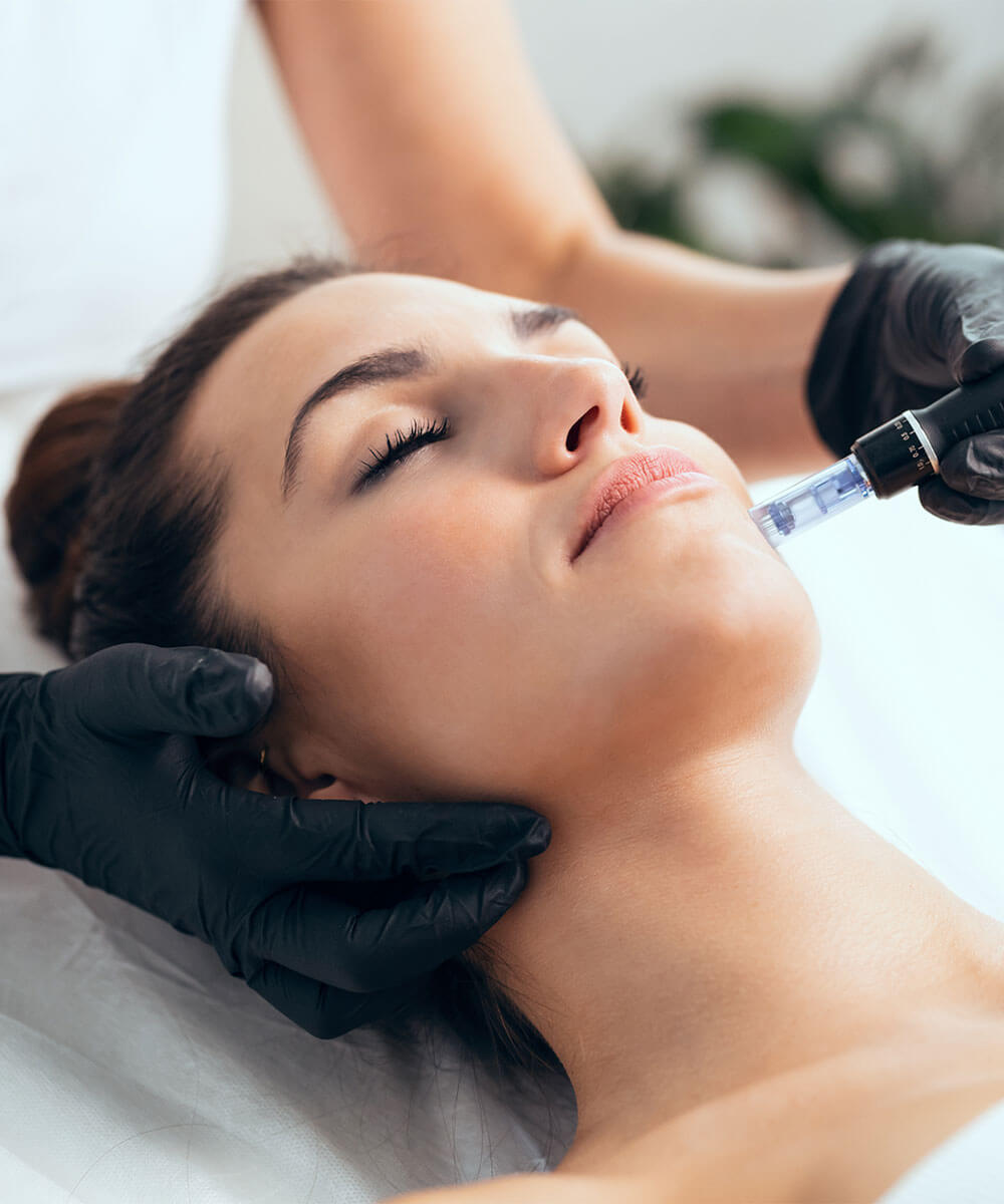 Microneedling