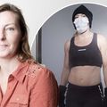 Cryo for RA Article Image - Daily Mail
