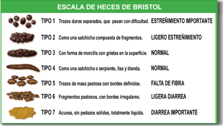 450px-Escala_de_Bristol.1