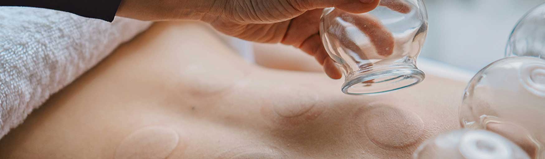 spavia-day-spa-cupping-setheight-hero