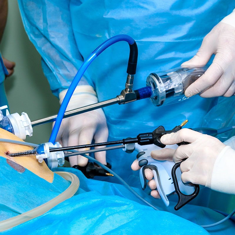 switchback-medical-catheter-delivery-system-in-or